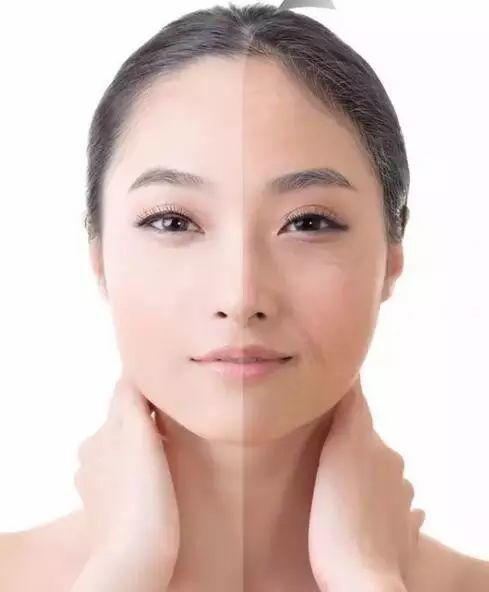 美容師必知的皺紋知識！