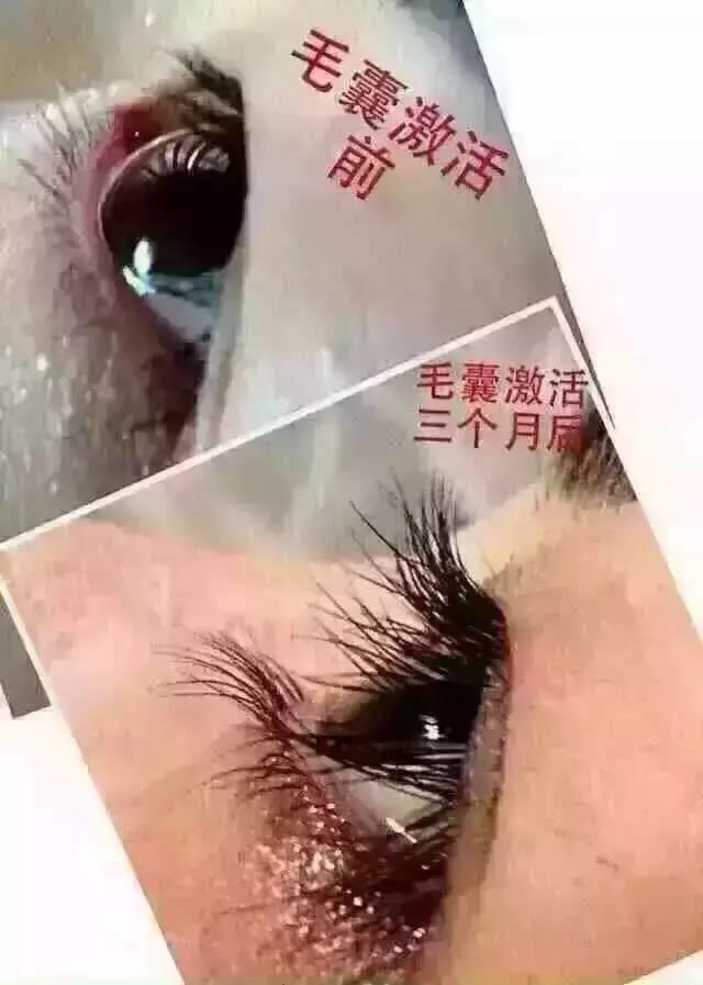 風(fēng)靡市場(chǎng)的孕睫術(shù)火了,自然美才是真的美,心動(dòng)不如行動(dòng)?。?！