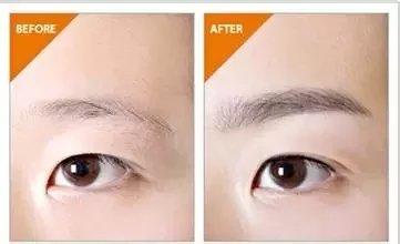 半永久化妝是微整形嗎？兩者有什么區(qū)別？