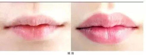 半永久化妝是微整形嗎？兩者有什么區(qū)別？